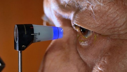 ¿Qué es el Glaucoma?