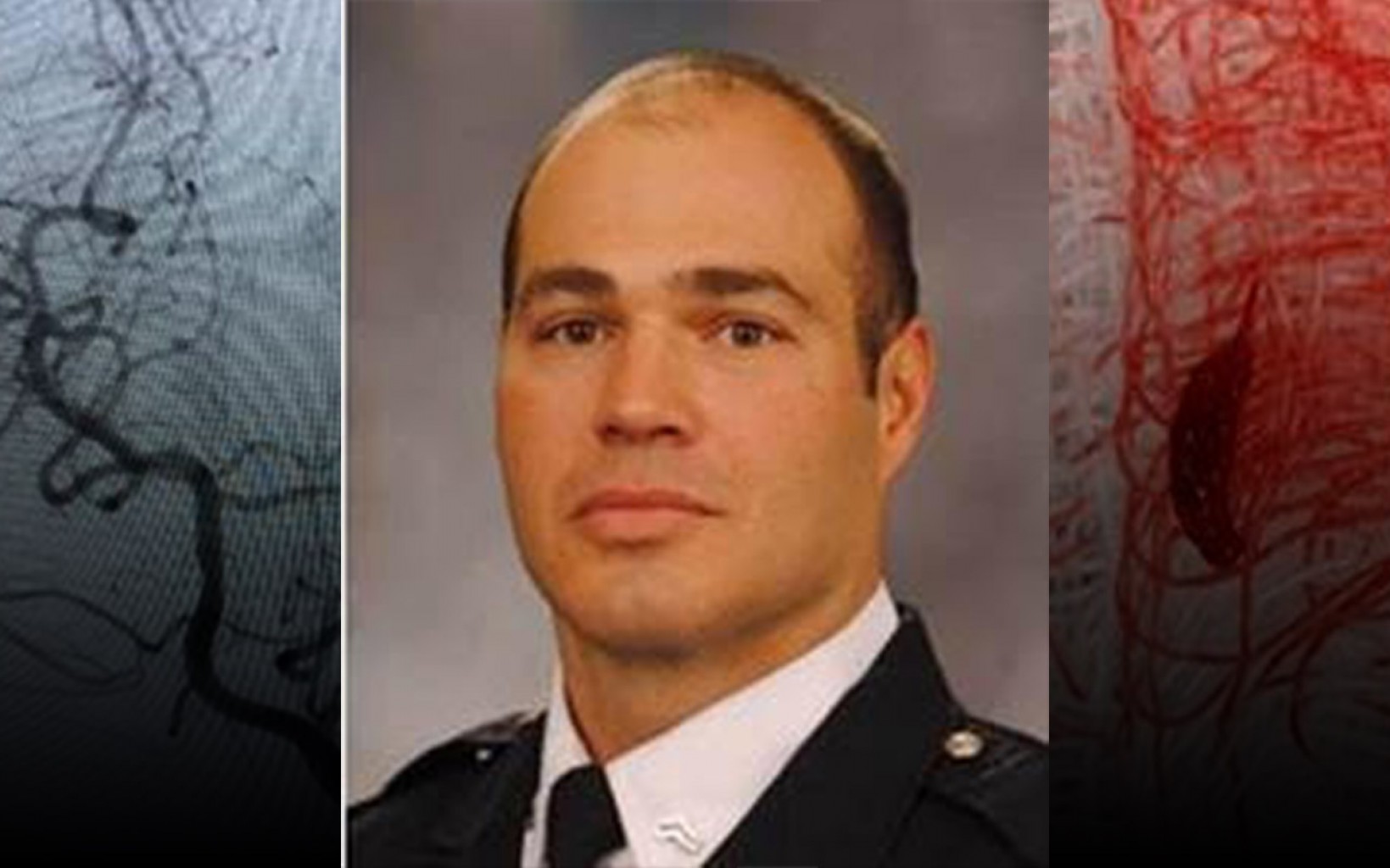 Bomberos salvan uno de los suyos después de un accidente cerebrovascular