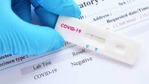 EEUU obtiene millones de pruebas rápidas para coronavirus