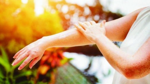 Integris Health analiza los desafíos y consejos de la piel durante el verano