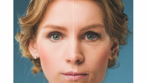 Las arrugas, el principal enemigo público