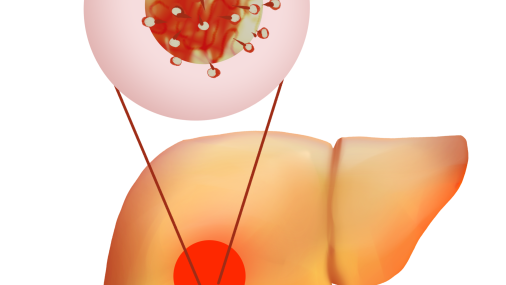 ¿Qué se sabe de la nueva hepatitis que afecta a los niños?