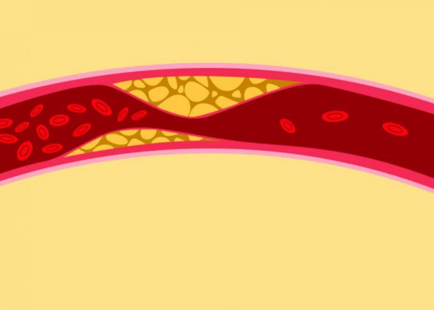 ¿Por qué es tan bueno el colesterol bueno?