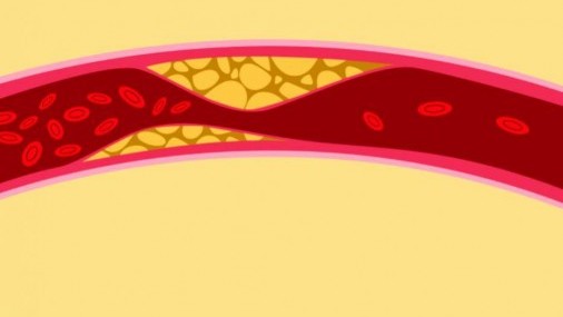 ¿Por qué es tan bueno el colesterol bueno?
