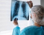 Oklahoma lanza HOPE para combatir el cáncer de pulmón