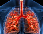 Mes de Concienciación sobre la Fibrosis Pulmonar
