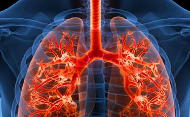 Mes de Concienciación sobre la Fibrosis Pulmonar